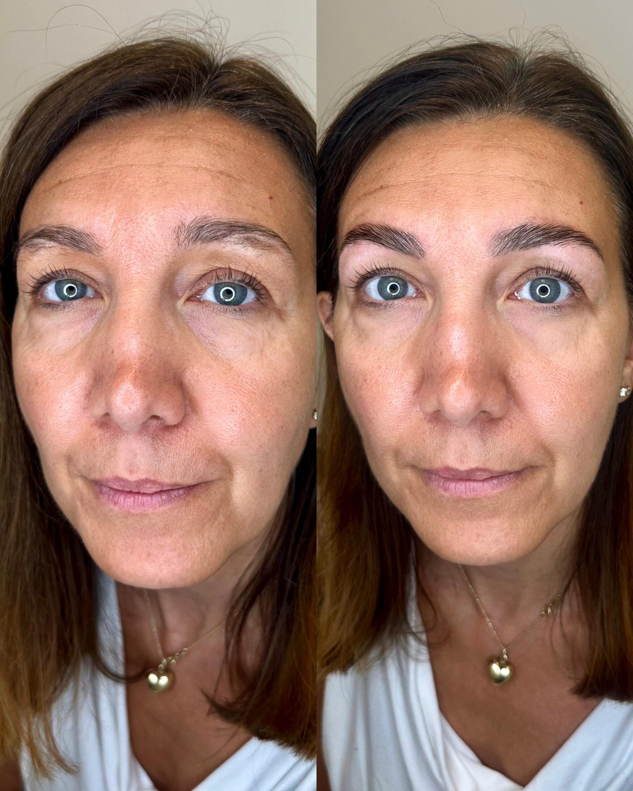 Prima e dopo trattamento Brow Bomber per sopracciglia: rigenerazione, fissaggio e nutrimento del pelo.