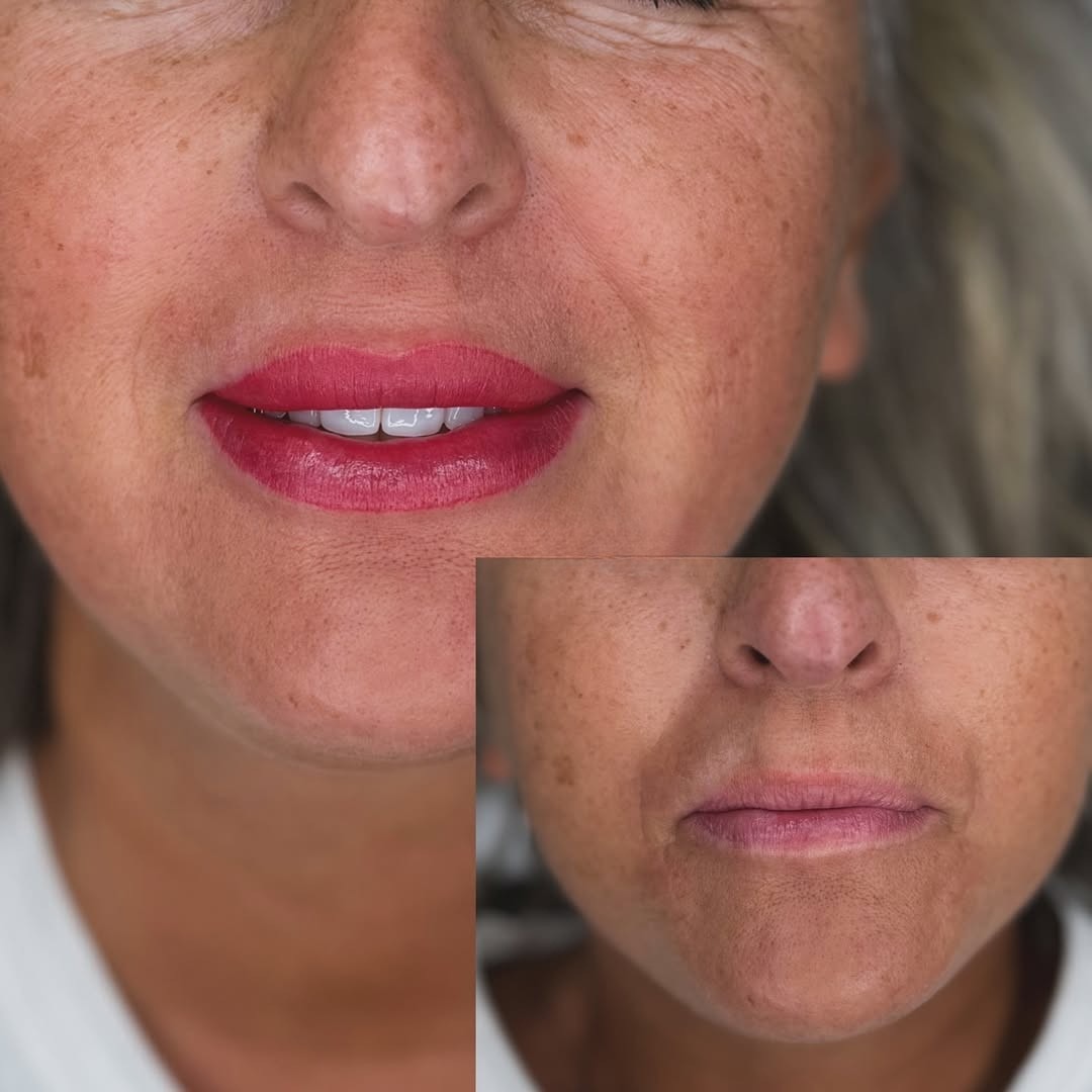Prima e dopo trattamento PMU labbra: trucco permanente che dona colore, definizione e armonia al sorriso